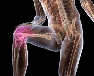 Zapalenie stawu kolanowego z artrozą