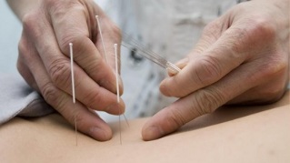akupunktura w osteochondrozy lędźwiowej