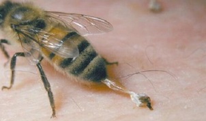 leczenie artrozy stawu biodrowego przez pszczoły
